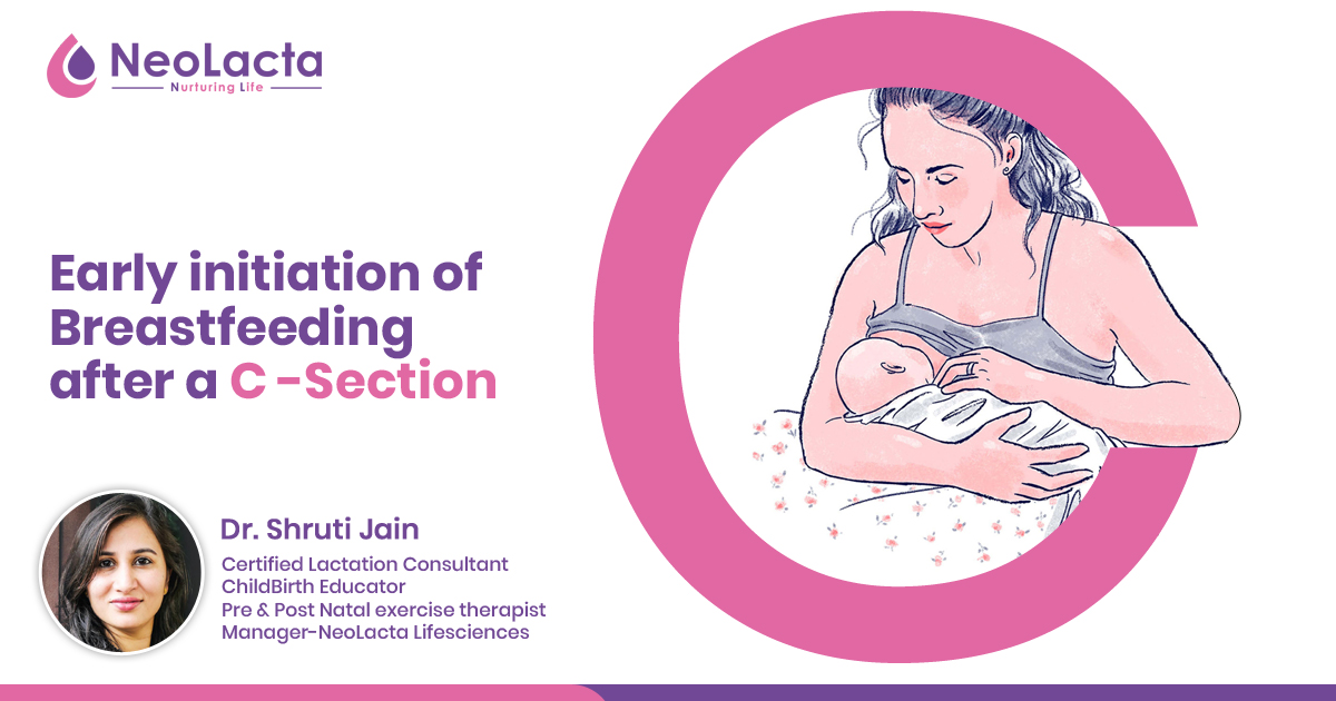 Early Initiation of Breastfeeding after a C-Section